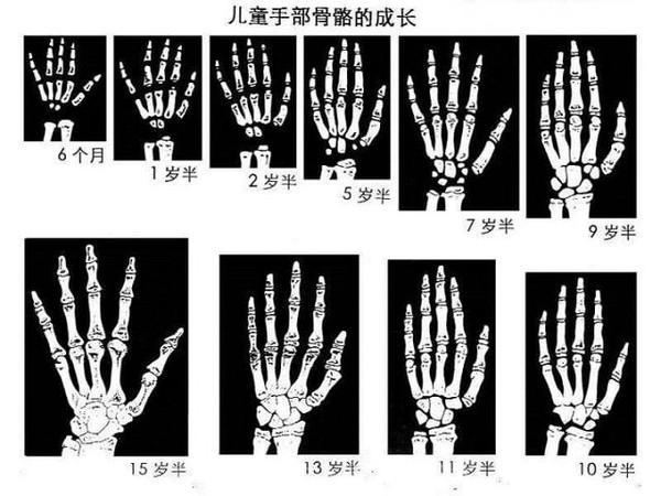 一二年级的小孩子,不能写作文!