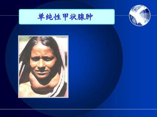 甲状腺肿的手术治疗效果观察与相关分析论文 2