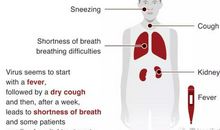 必背|新冠状病毒英语评分作文