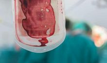 汉中男子输血后感染丙肝！