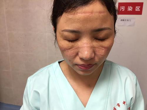 “疫”线面孔读后感｜杭州惠兴中学808班张轩瑀：书写不平凡的人生