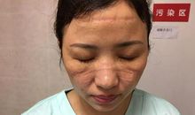 “疫”线面孔读后感｜杭州惠兴中学808班张轩瑀：书写不平凡的人生