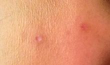 不结痂的疤 优秀读后感800字