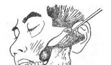 口腔颌面部损伤健康保健效果探析论文