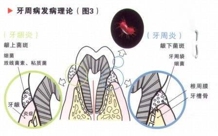 老年人牙体牙周疾病就诊原因分析论文