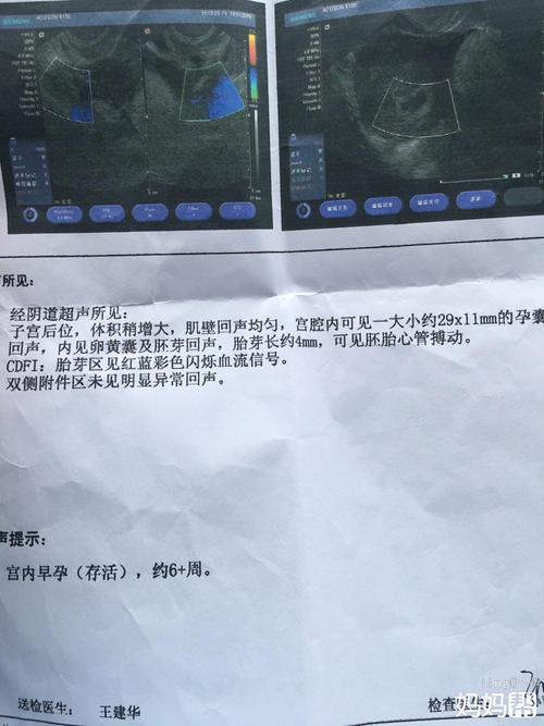 [7月的向往]我很想回到0_900字的时候