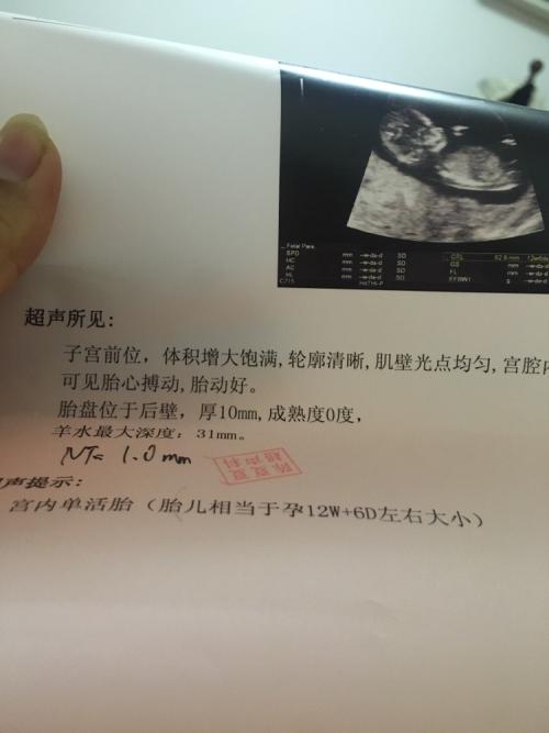 我看到男孩和女孩_450字