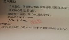 我看男女生_450字