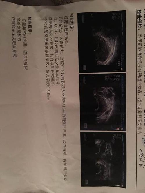 [学生征文11]：我将在小生初取胜，我脚踏实地，冷静。