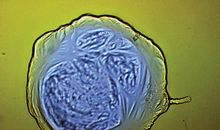 生命·气泡_450字