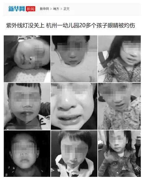 那些灼伤的眼睛