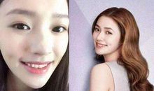 都是牙套惹的祸