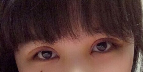 第二大眼睛