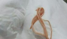 这脑袋里一定有虫_800字