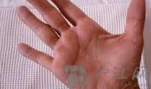 一双布满死茧的手