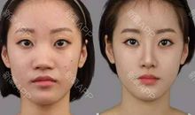 鼻子一酸的经历