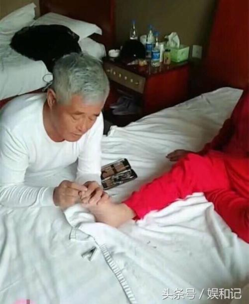 切趾甲