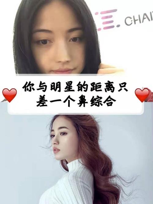 我的演员梦