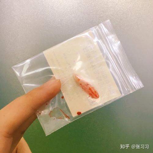 拔牙冒险