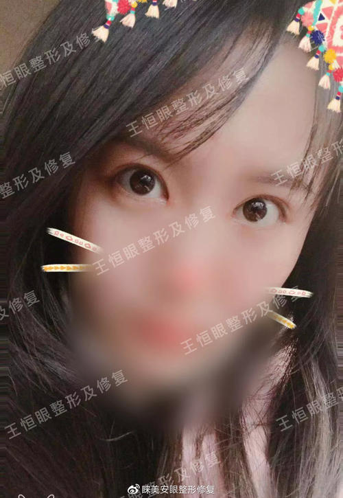 眼睛的美丽和丑陋