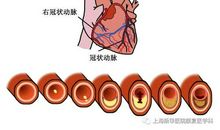 我与楼梯的那些事儿