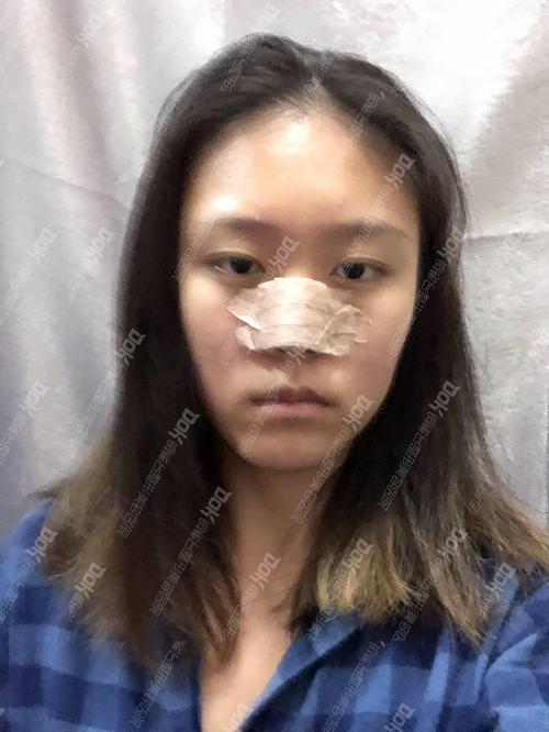 缺陷也可以是美丽的