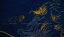 穿梭在针线中的爱