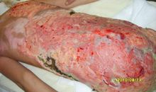 面对那双脚我流泪了