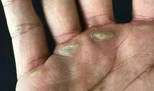 那双结满老茧的手