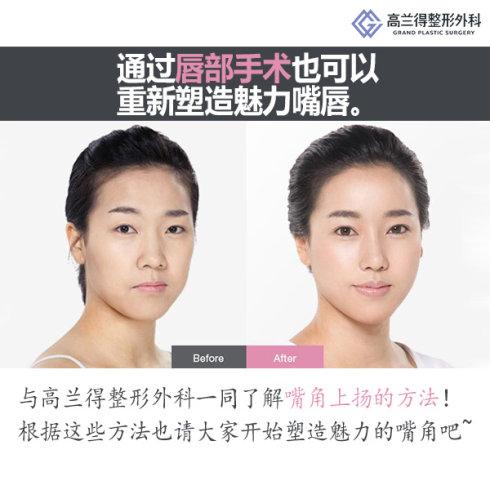 少年用嘴巴举起
