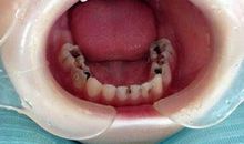 嫉妒心终酿成大祸