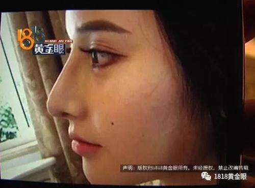 我想告诉你的眼睛
