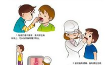 被鱼刺卡喉的滋味