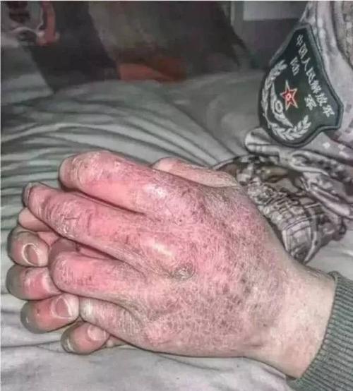 那些冷酷的手