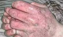 那双长满茧的手