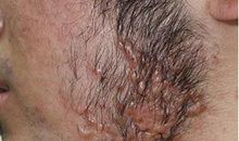 带着疤痕的男孩