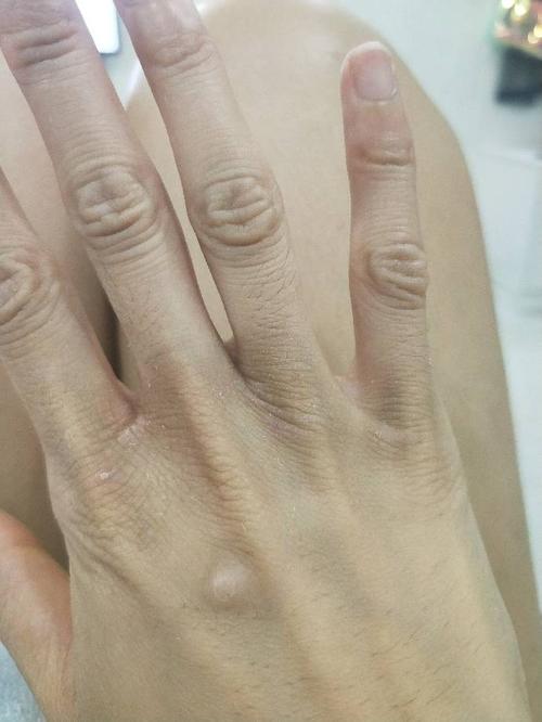 粗糙的手指