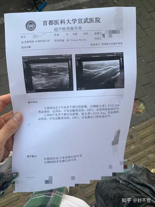 我终于松了一口气