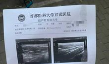 我终于松了一口气