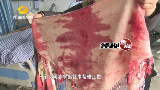 突然的一幕