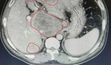 都是镜子惹的祸