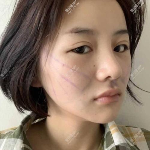 哦，我明白了