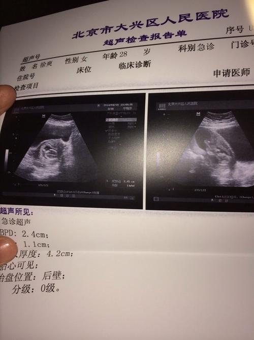 我刚吃过畸形药