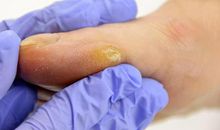 藏在老茧中的精彩