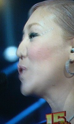 鼻子不见了