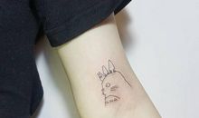 手臂上的“小花”