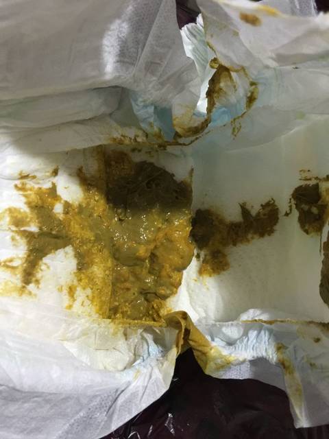 不寻常的爱