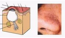 我与“黑头”的一场大战