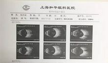 我的一次正确的决定
