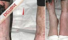 那些伤痕累累的日子